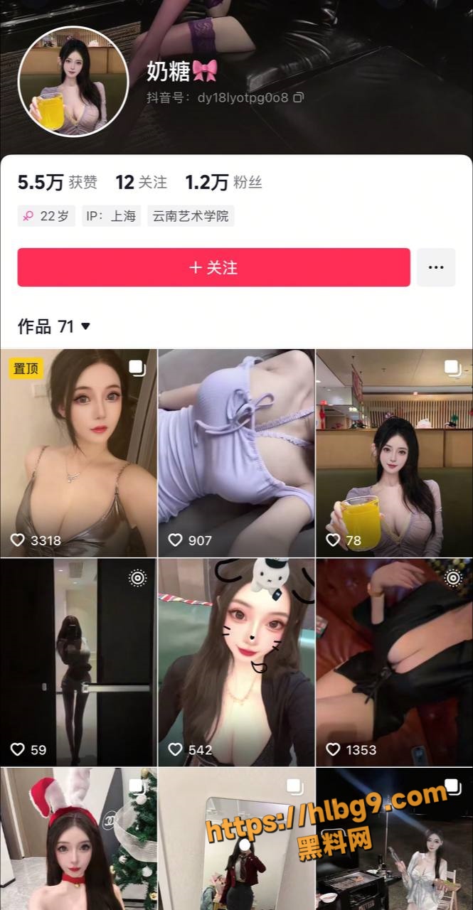 665X1280