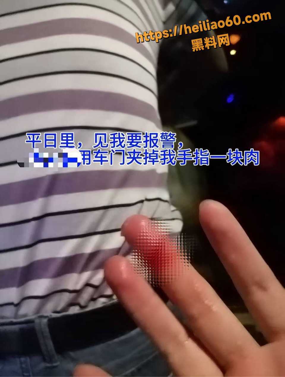女子术后被领导强奸事件1